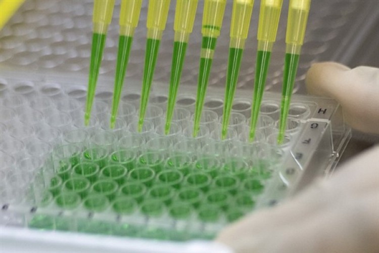 DSÖ: Kuş gribine karşı mRNA aşısı gelişimini ilerletmek için yeni girişim başlatıldı