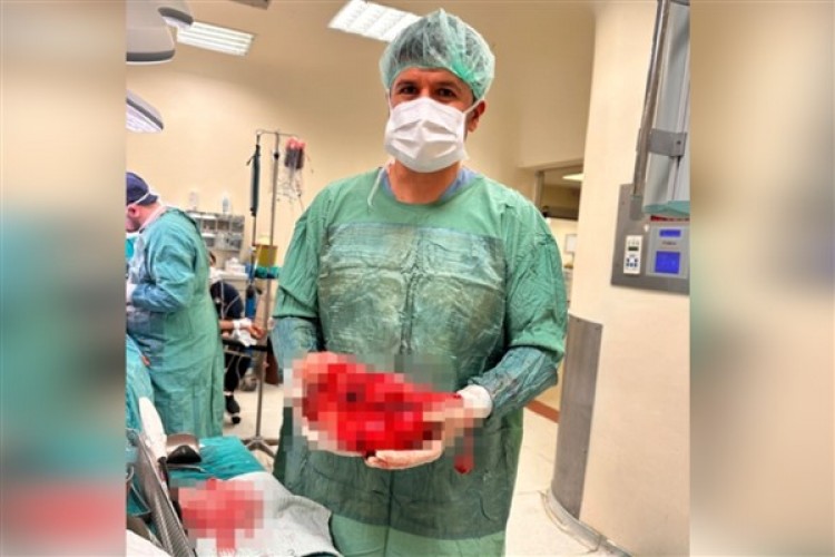 Şanlıurfa'da bir hastanın karnından 5 kilogramlık böbrek tümörü çıkarıldı
