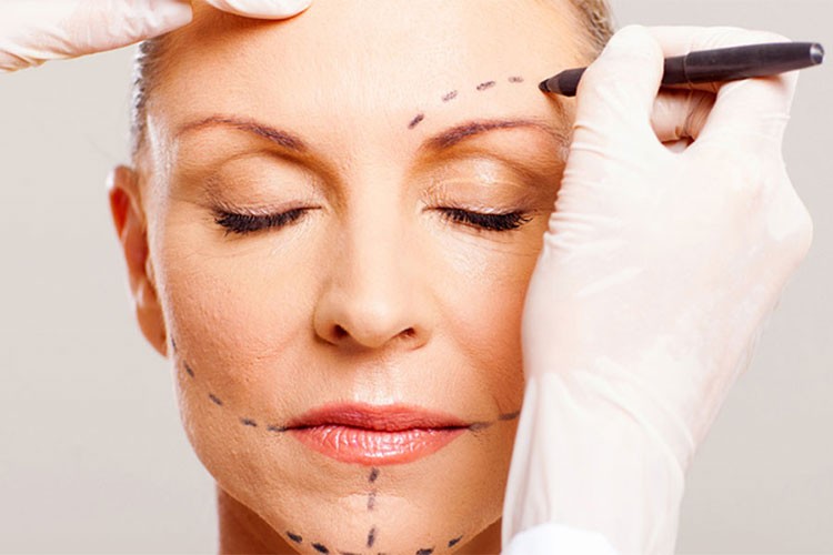 Yüz germe operasyonlarında yeni nesil teknikler