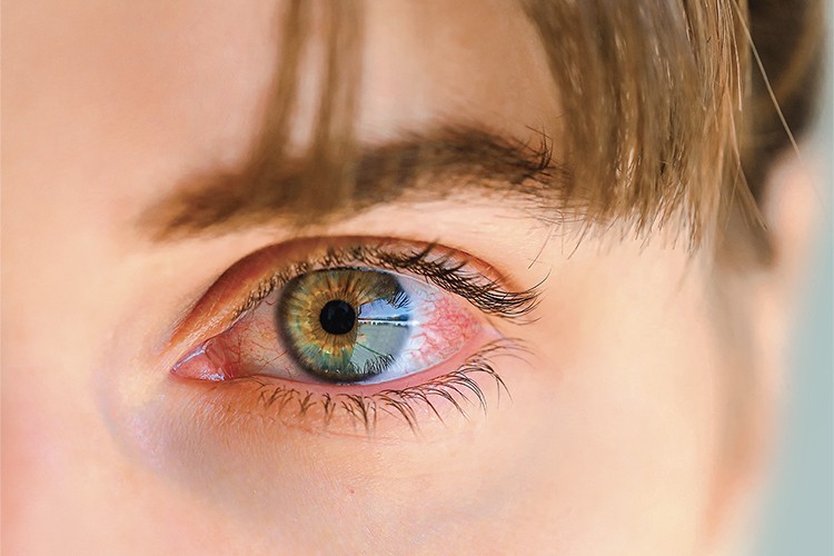 Göz muayenesi hayat kurtarır