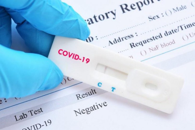 5 dakikada sonuç veren test kiti