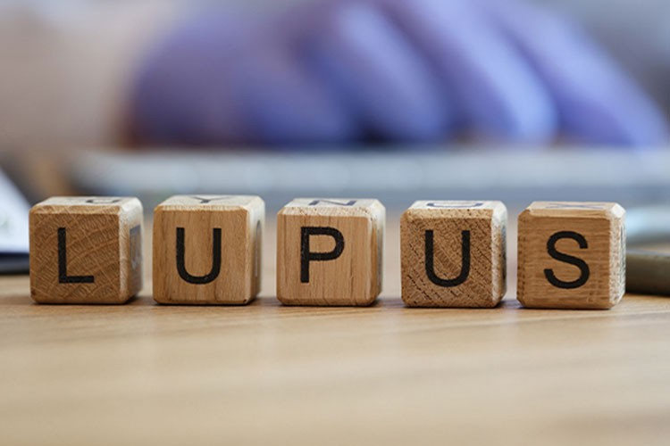 Yüzünüzdeki lekeler lupus belirtisi olabilir