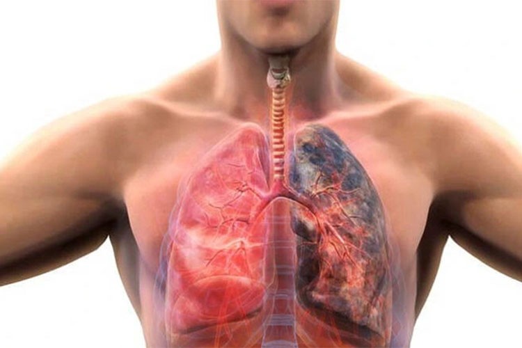 KOAH'ta yeni tedavi seçeneği "biyolojik ajanlar"