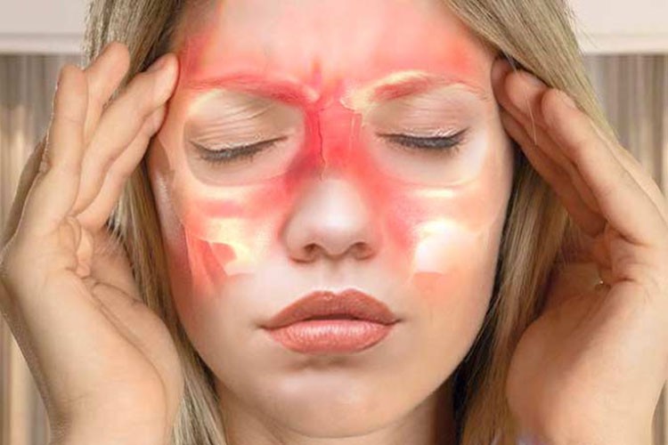 Sinüzitin nedenleri ve tedavisi