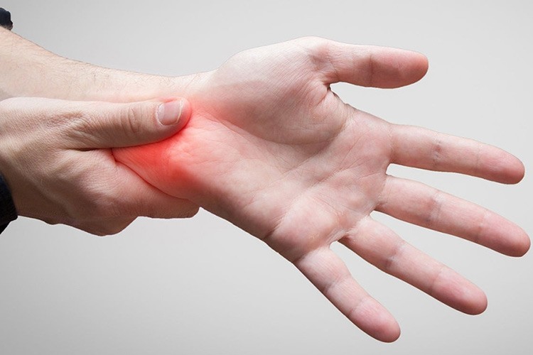 Karpal Tünel Sendromu'na ilişkin değerlendirme