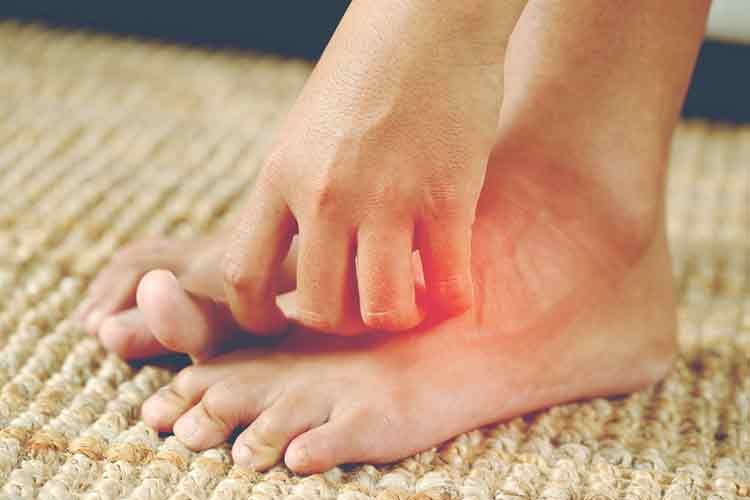 Mantar hastalığı hakkında bilinmesi gereken 6 önemli bilgi