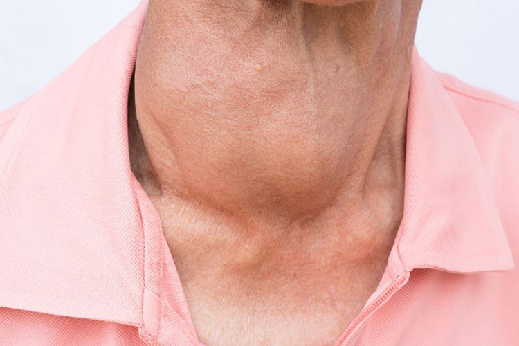 Tiroit hastalıkları göz sağlığını tehdit ediyor