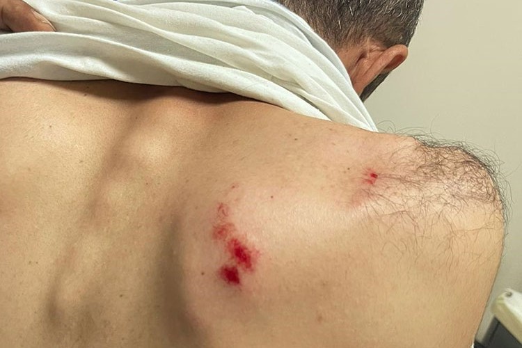 Siirt'te Dicle Elektrik ekibine saldırı