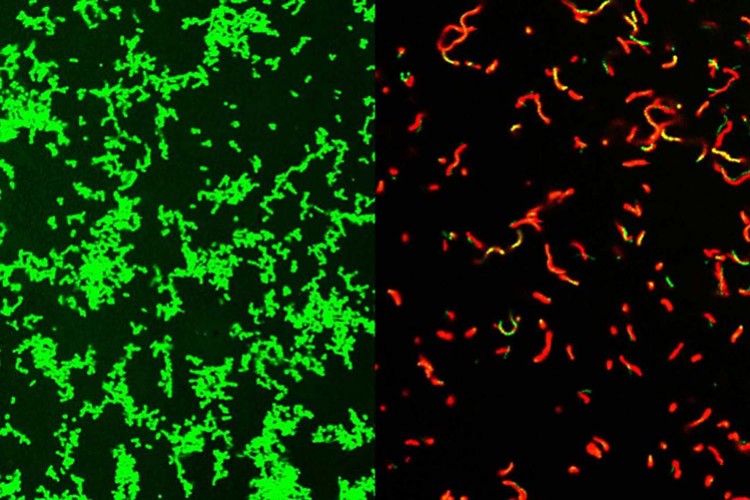 Et yiyen bakteriye karşı yeni yöntem geliştirildi