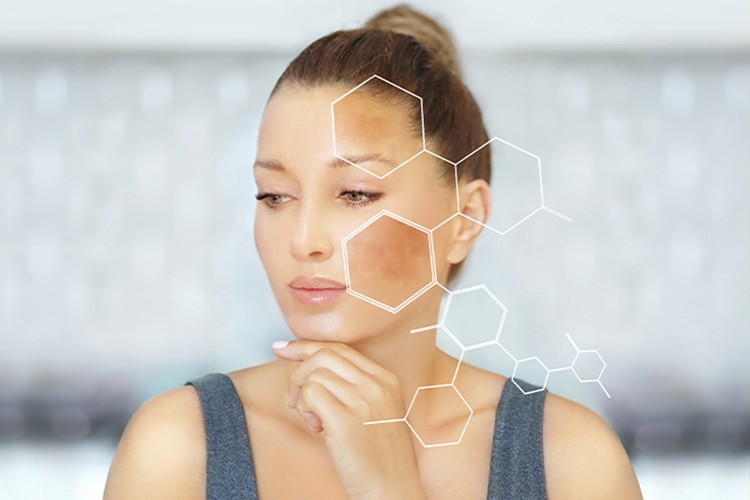 Cildinizdeki Lekeler Sizi Uyarıyor Olabilir