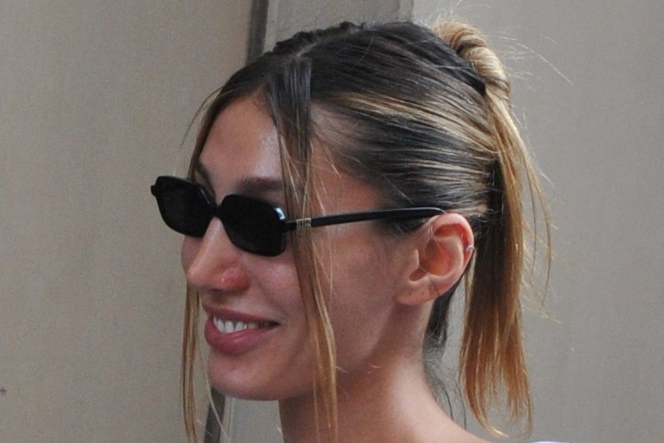 Şevval Şahin alerji oldu