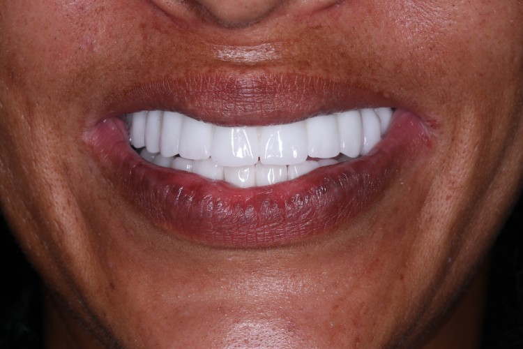 BIANCA SHERLOCK'UN HİKAYESİ: TÜRKİYE' DE TEDAVİ OLDU VE AİLESİNİ BULDU