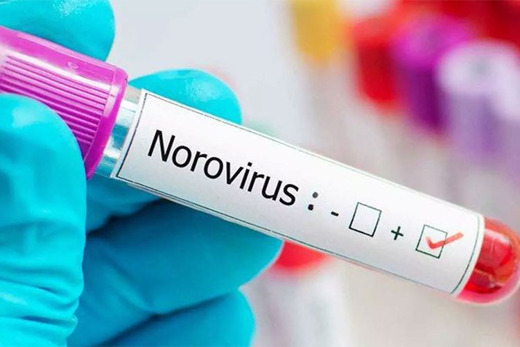 Norovirüs'e ilişkin değerlendirme: