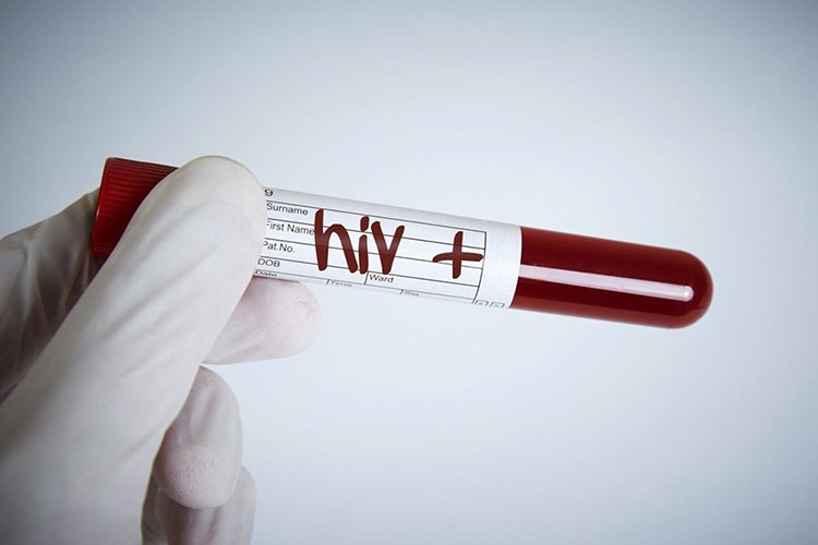 HIV ile mücadelede toplumsal farkındalığı artırıyor