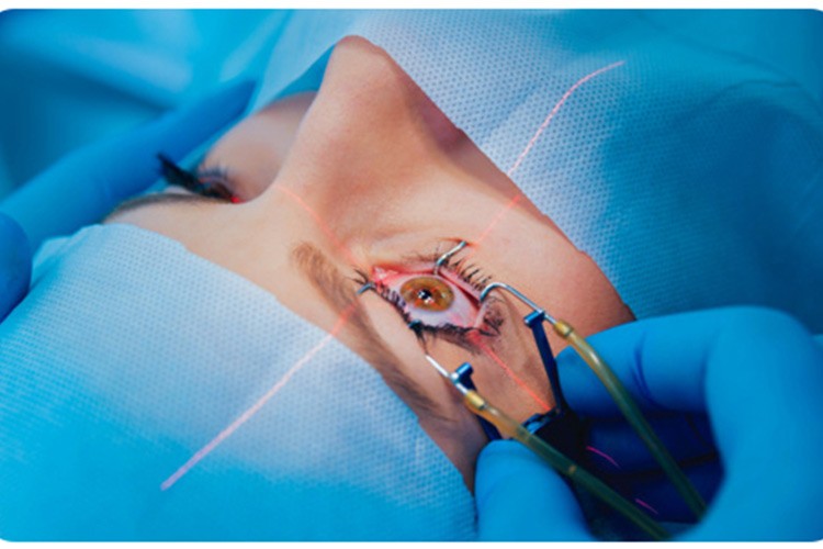 Fakik Göz İçi Lens ve No Touch Lazer tedavi yöntemi