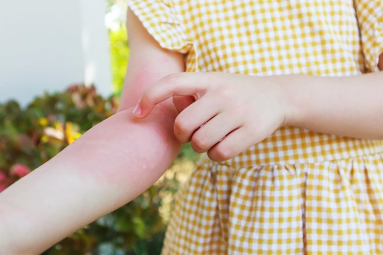 Parvovirüsü çocuklar arasında salgına dönüşebiliyor