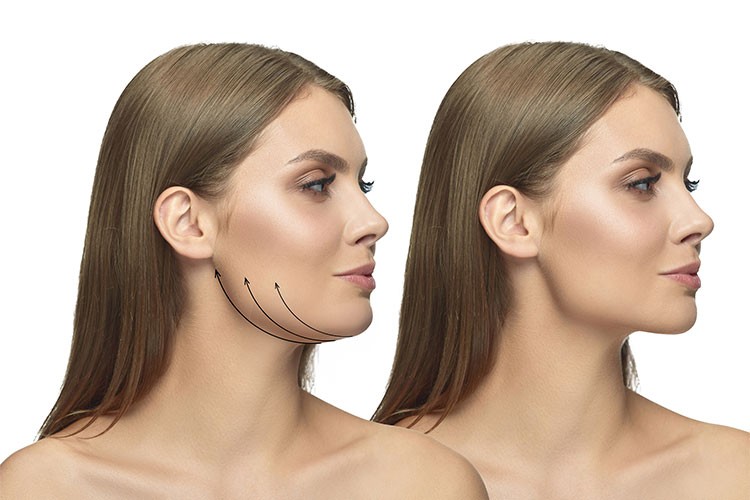 Çene hattını ve gıdıyı bir ayda forma sokan formül