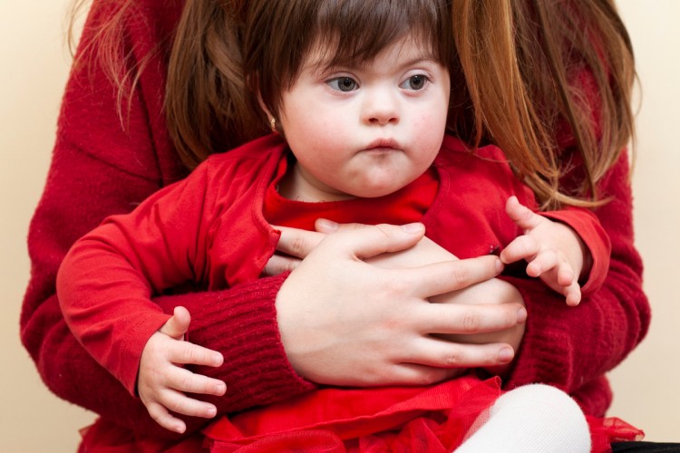 21 MART DÜNYA DOWN SENDROMU GÜNÜ